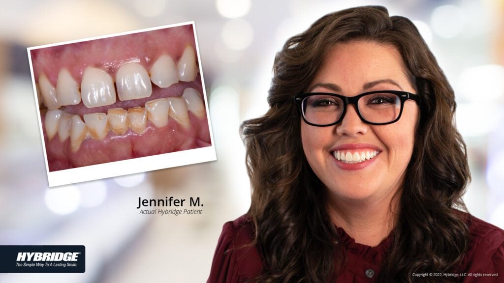 before-after_smile_gallery_w-bkgds_jennifer-m_1920x1080_2