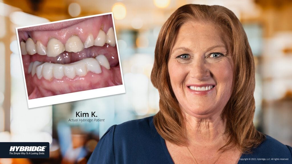 before-after_smile_gallery_w-bkgds_kim-k_1920x1080_21