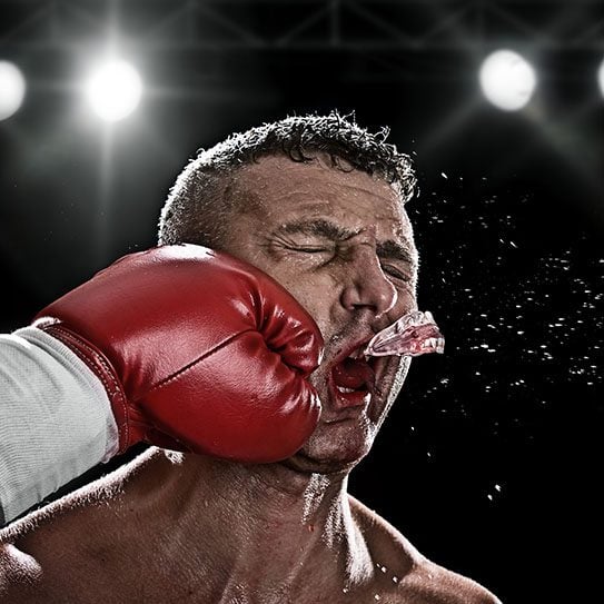 traumatic dental injuries dental trauma